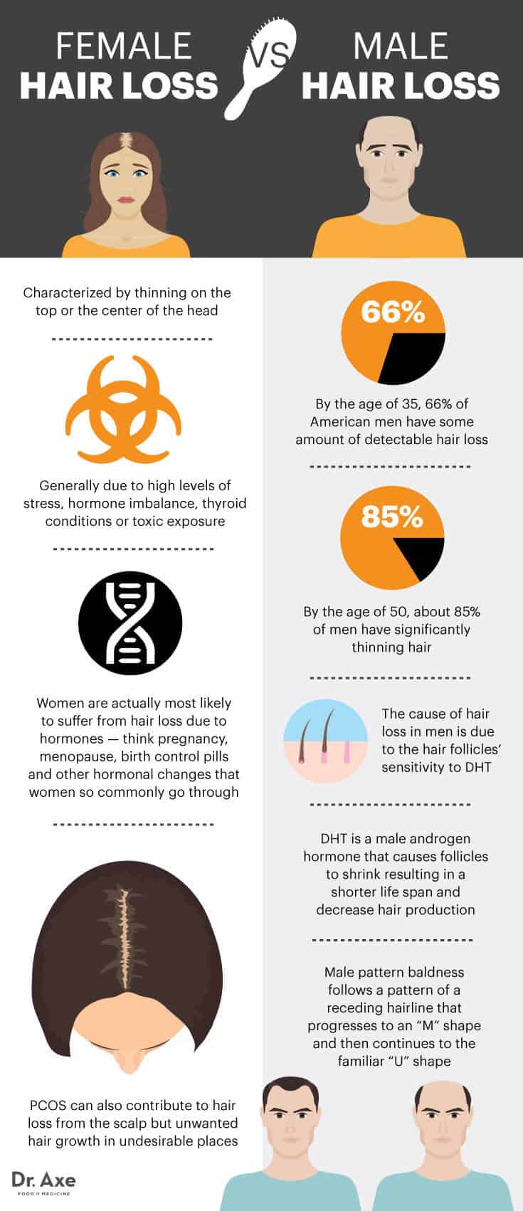 Female vs. male hair loss - Dr. Axe