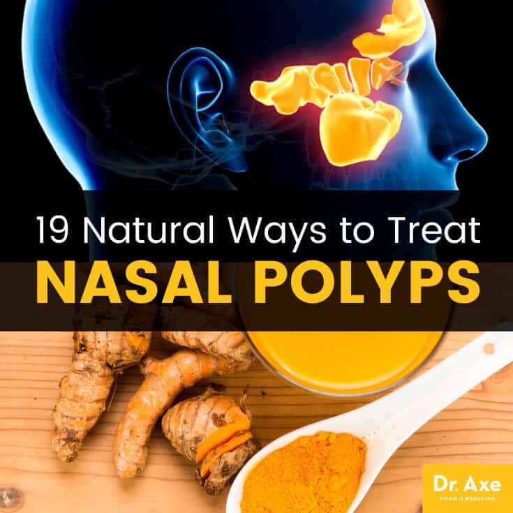 Nasal polyps - Dr. Axe